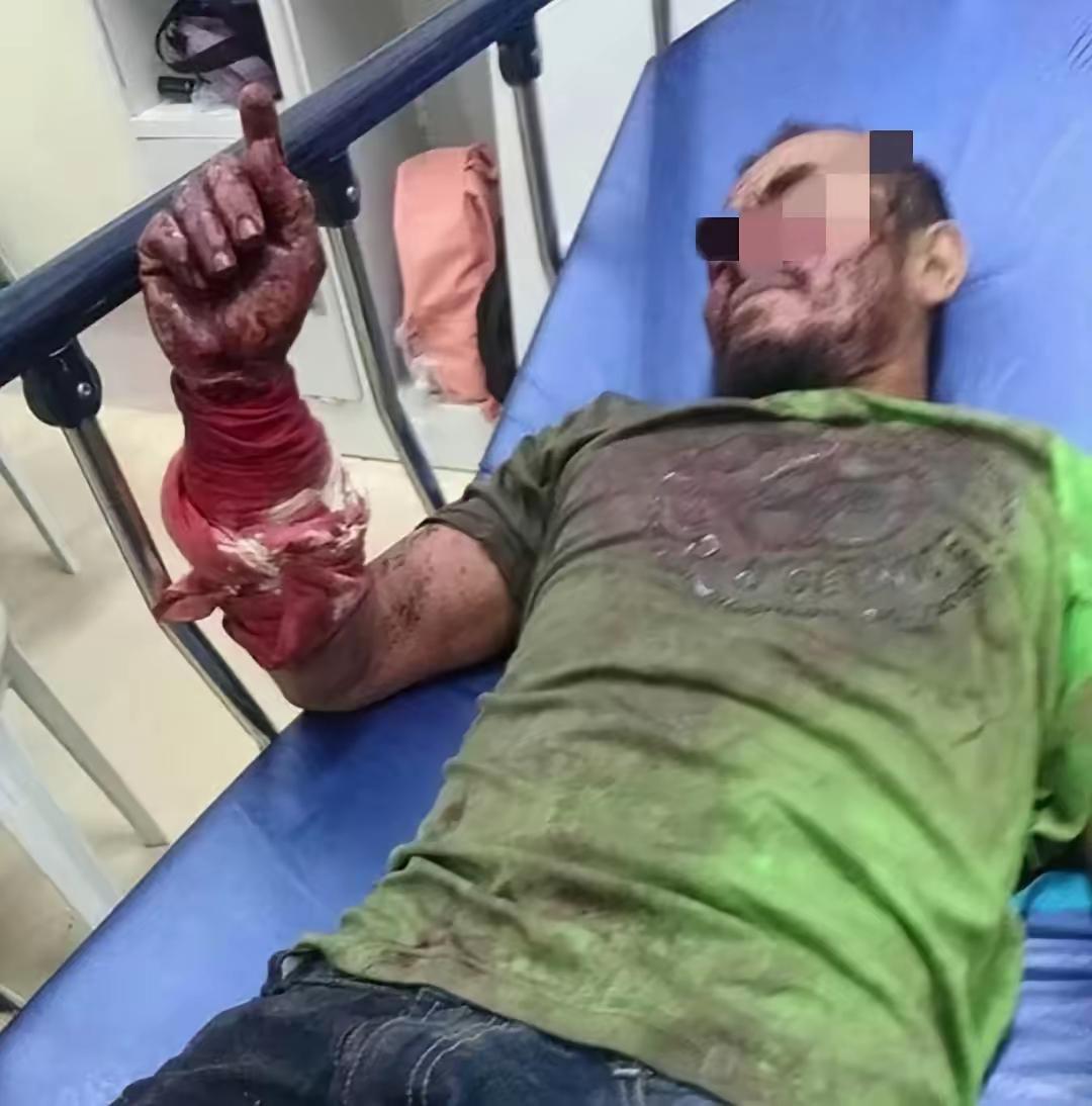 2014年，美国一位男子为了验证蟒蛇口中逃生的可能，穿上特制防护服，让水蟒生吞自