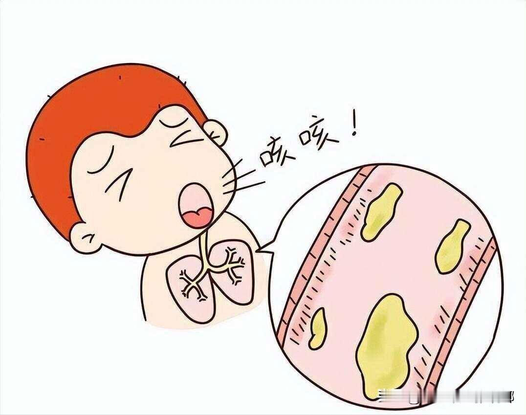 痰由百病生，热生痰、寒生痰、气滞也生痰，教你1招，甩干一身痰

1、因热生痰。
