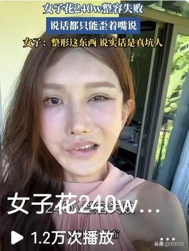 吓一跳！豪砸240万整容，最后嘴都歪了！
 简直不敢相信！花了整整240万去整容