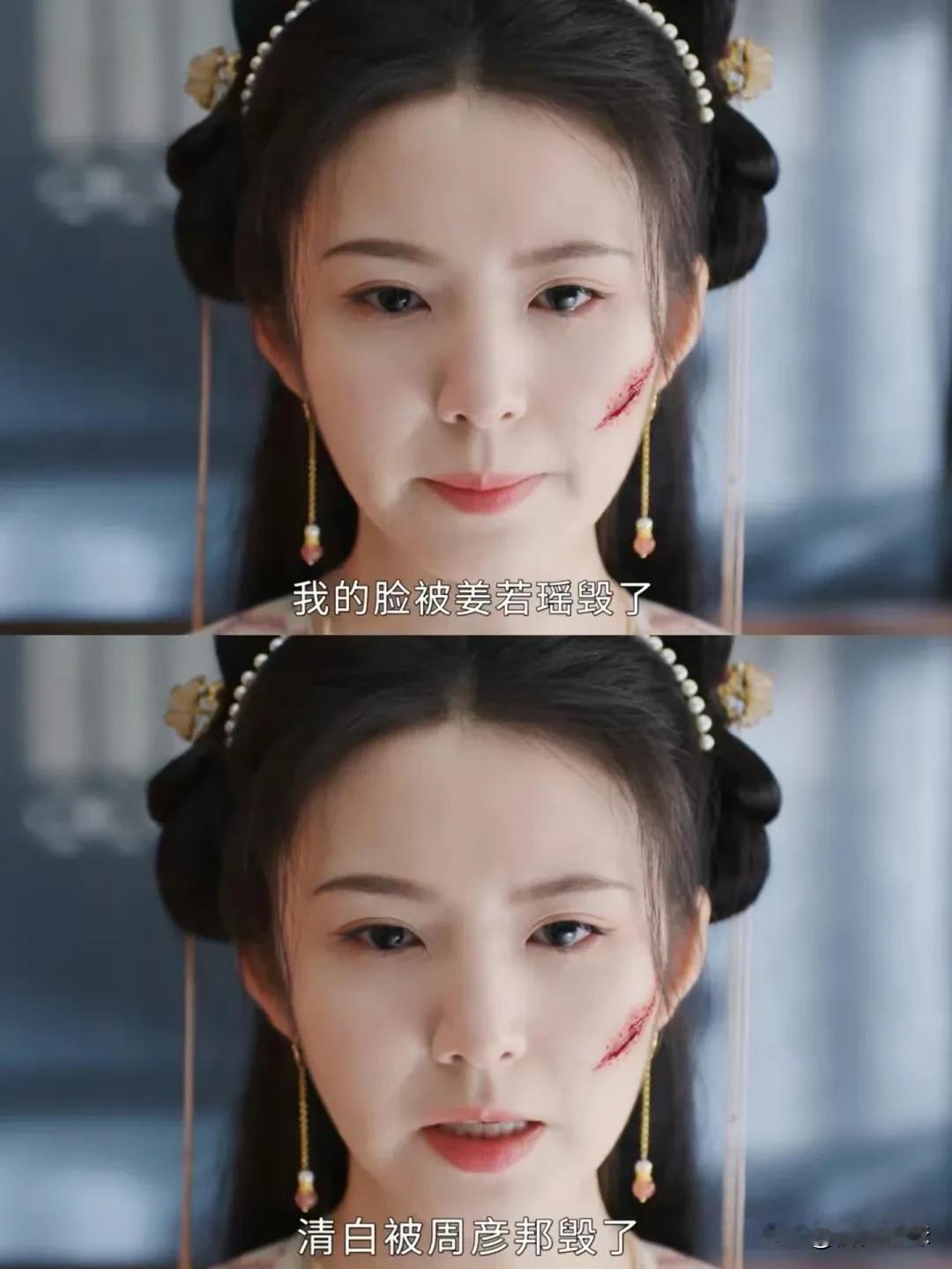 姜玉娥被毁容反击，她要嫁给周彦邦
姜若瑶抓到姜玉娥和周彦邦睡了，气得发疯当众把她