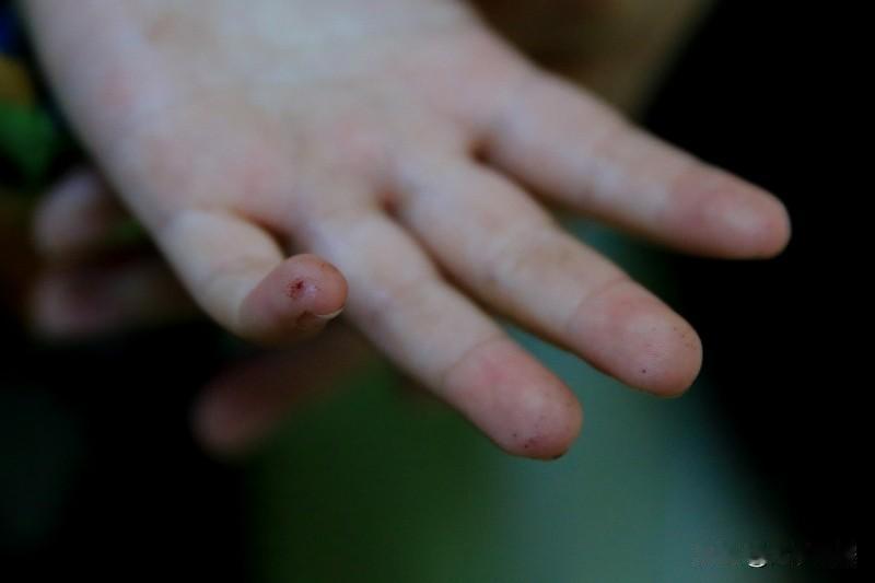 过多摄入糖，身体可就遭老罪啦！首先，血糖会像坐火箭一样飙升。身体为了降低血糖，胰