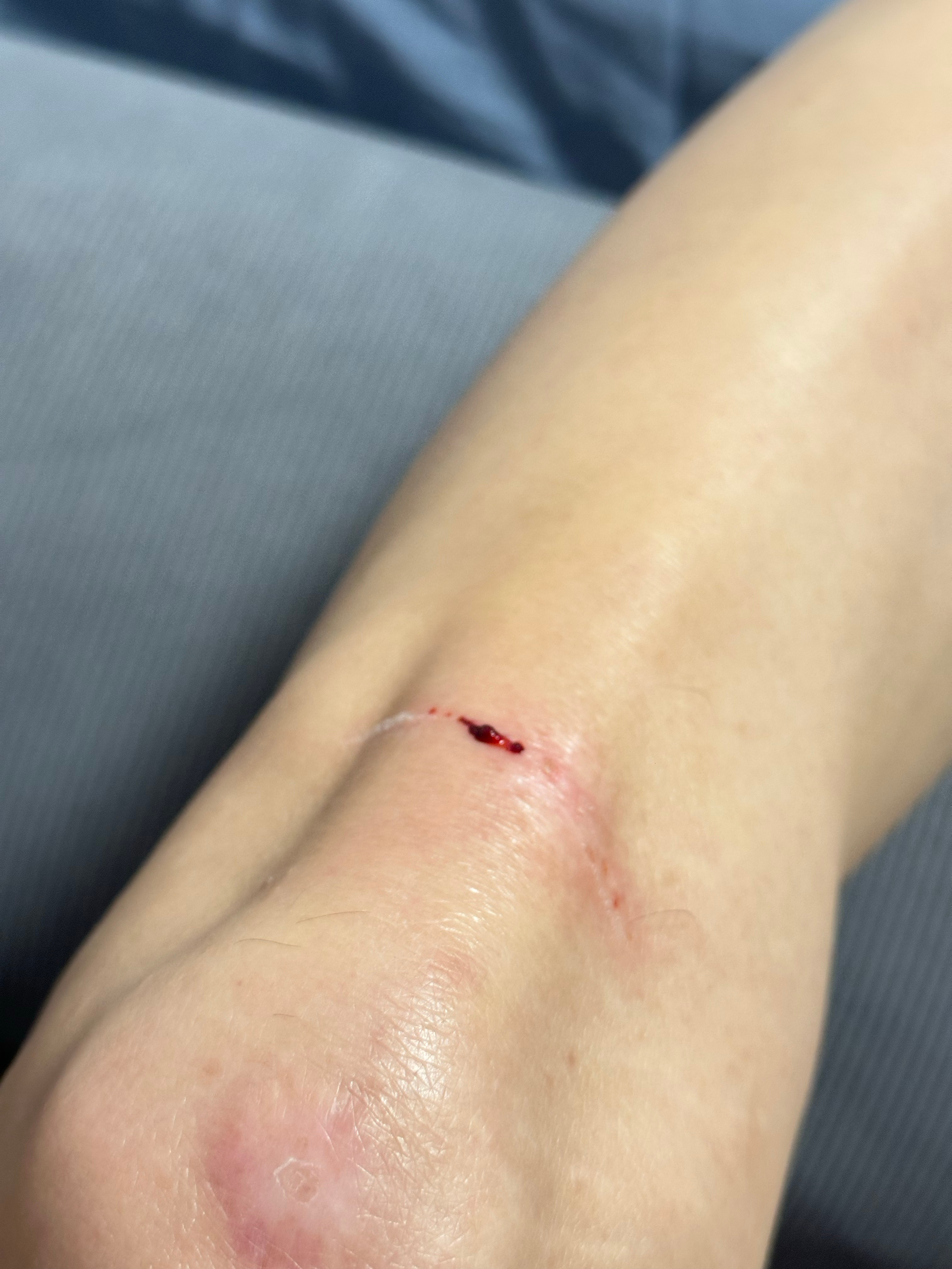 玩手机被沙发划了一下