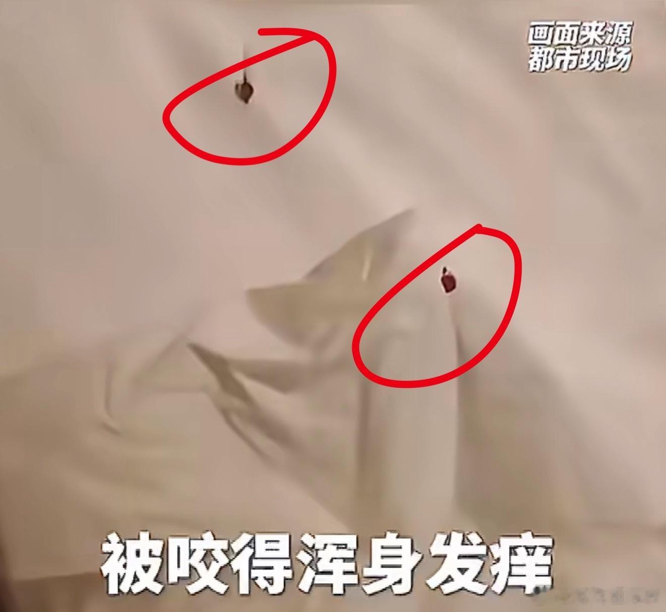 上海 床虱看完这个新闻真的头皮发麻，连锁酒店房间出现大量床虱，客人维权处理拖沓，
