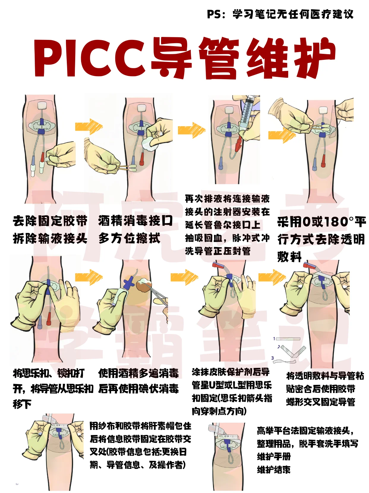 医学生笔记📒：图解PICC导管维护👆