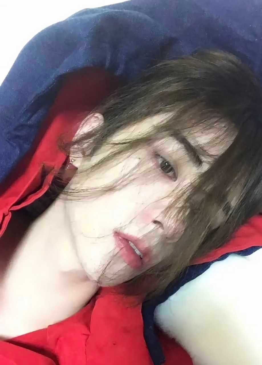【邓孝慈】前夫有很多但是前妻只有这位  正式确诊为痣性恋 ​​​