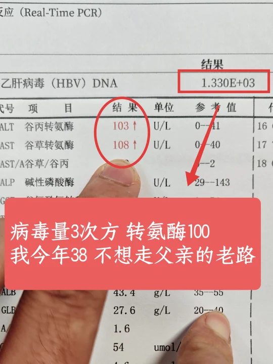 “四年前，肝硬化带走了他，临走前父亲全身泛黄、眼神空洞。连我是谁都不认...
