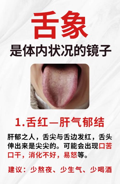 一图看懂 6 种舌象，对照自查身体状况