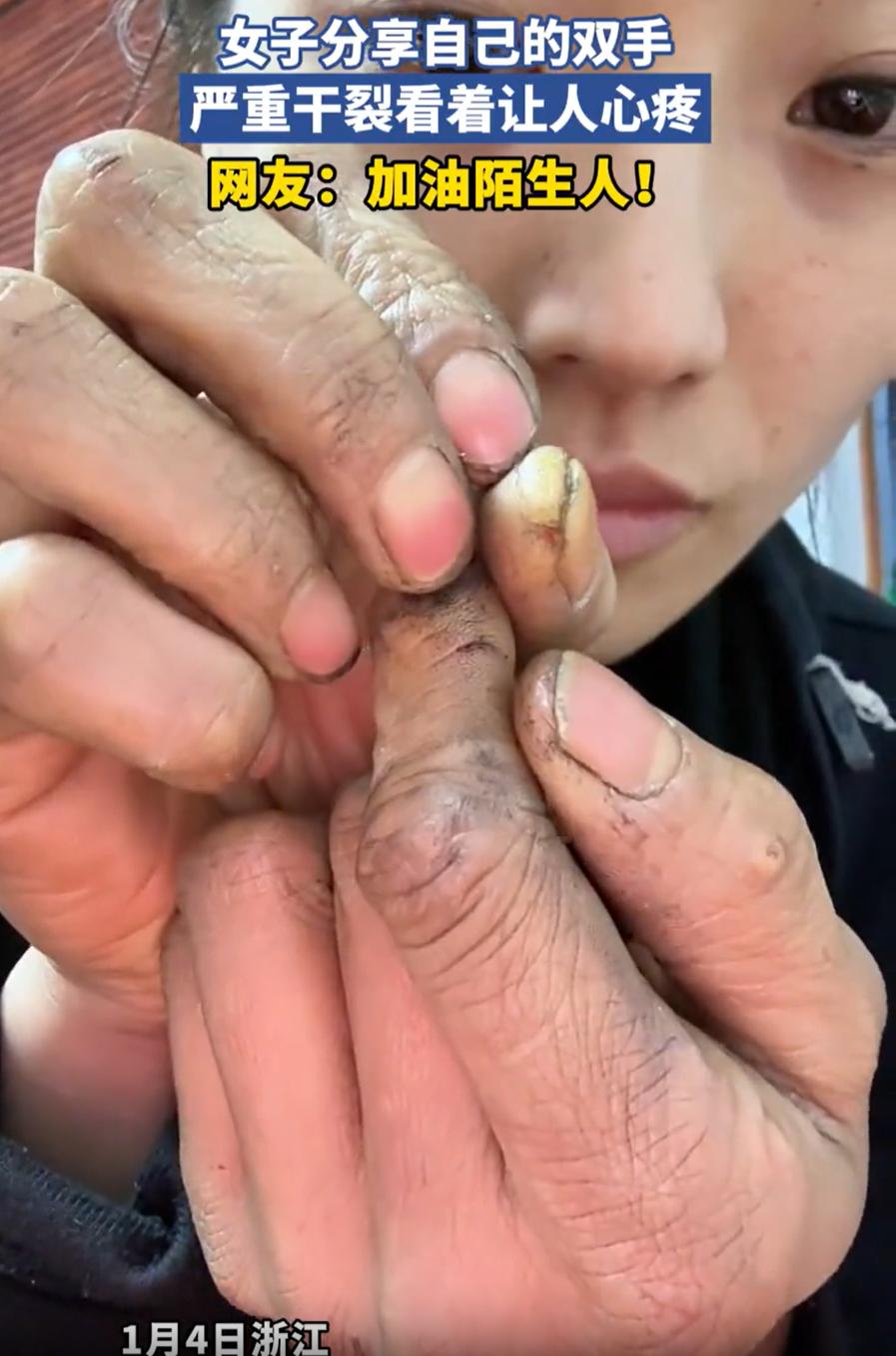看的心疼！浙江，一女子在网上分享自己的双手，可她的手上没有美甲，也不是细腻白皙，