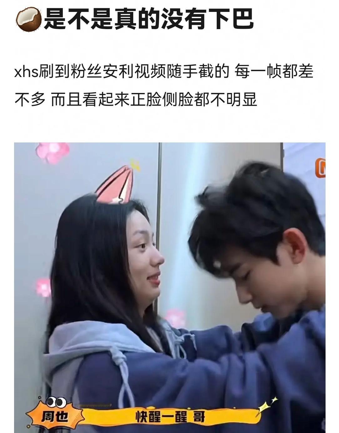 周也也是下巴后缩吗？ ​​​