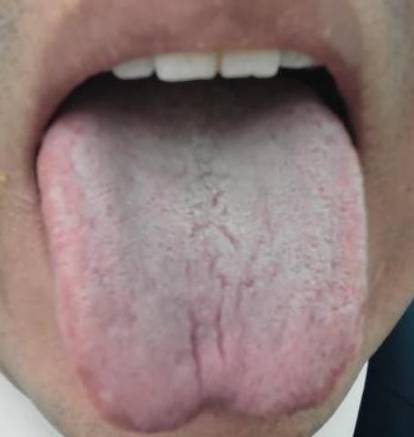 舌头有这 3 个痕迹，是脏腑在求救！
大家好，我是中医陈大夫！
最近好多人问：舌