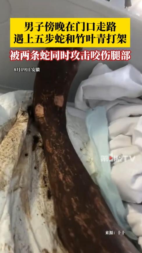 “这也太倒霉了！”8月19日，安徽，一男子在家门口走路，结果，遇到五步蛇和竹叶青