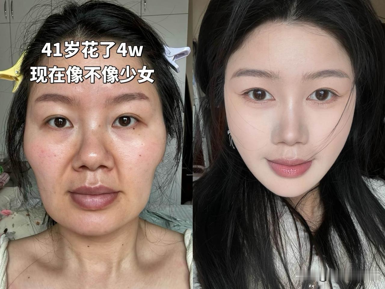 哪位大神能告诉我，现在的医美已经强到这种地步了？