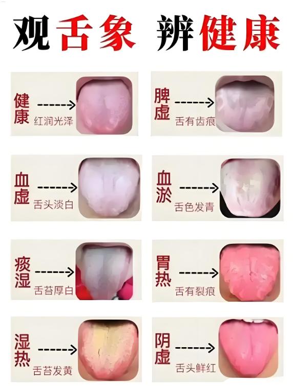 公益舌诊辨证，坚持每天看舌象！

应粉丝的要求，继续为大家的健康保驾护航！

先
