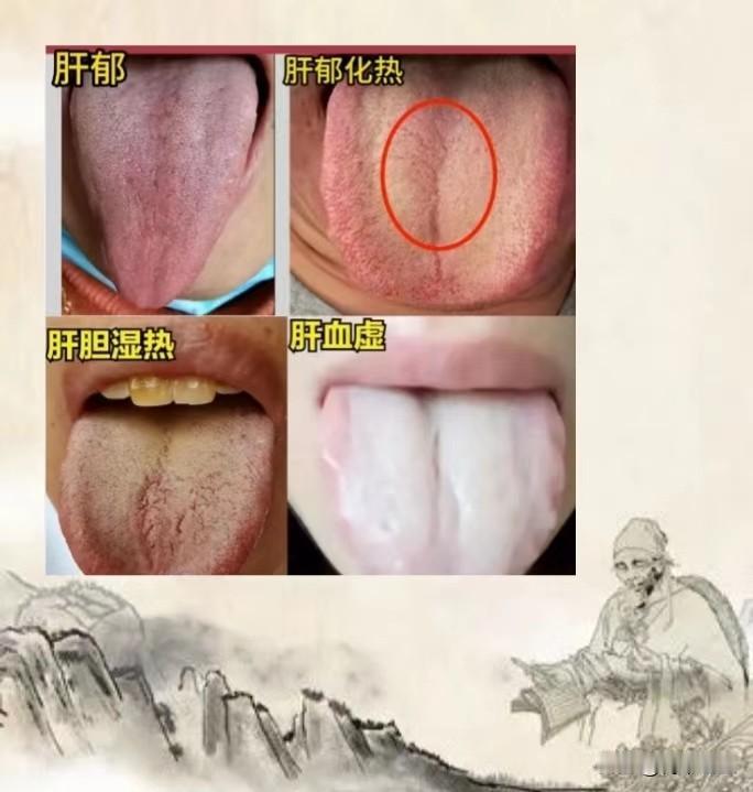 应粉丝要求，今天继续免费为大家看舌象，你发我看，尽量拍清晰，不要使用美颜，现场告
