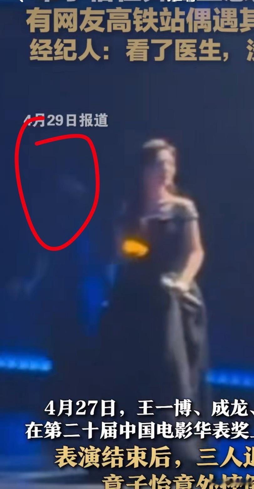 章子怡舞台上意外摔倒已就医天哪！看视频感觉是一整个人跌下去，不知道受伤严不严重，