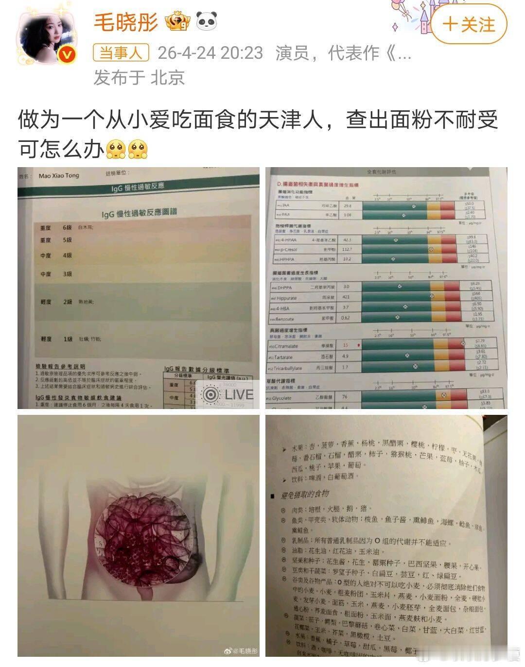 毛晓彤回应去医美诊所注意身体啊 