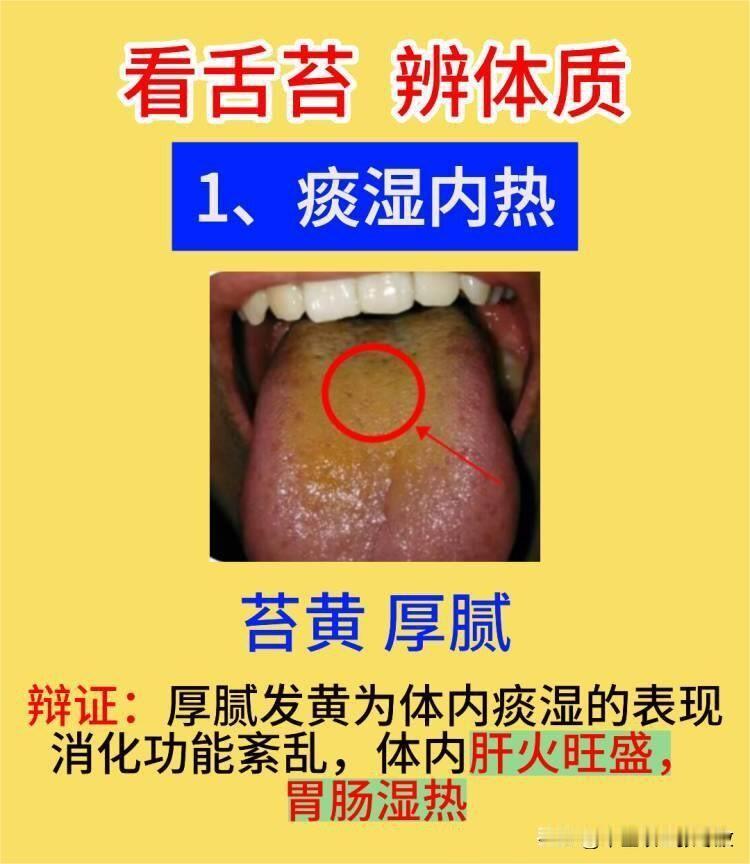 脾肾阳虚，手脚冰凉，尿黄便秘
胃痛胃胀，消化不良，失眠乏力
六个最常见的舌象以及
