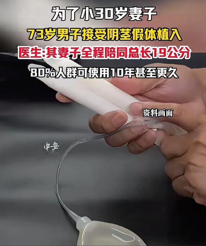 “还是大爷玩的花！” 谁能想到，一位 73 岁的大爷，为了能让比自己小 30 多