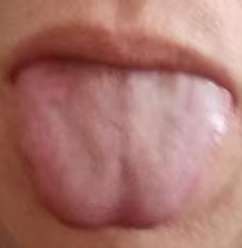 宗筋弱而敏感多肝肾亏虚，补脾肾、散湿瘀，气血充足自能强健







不少男同