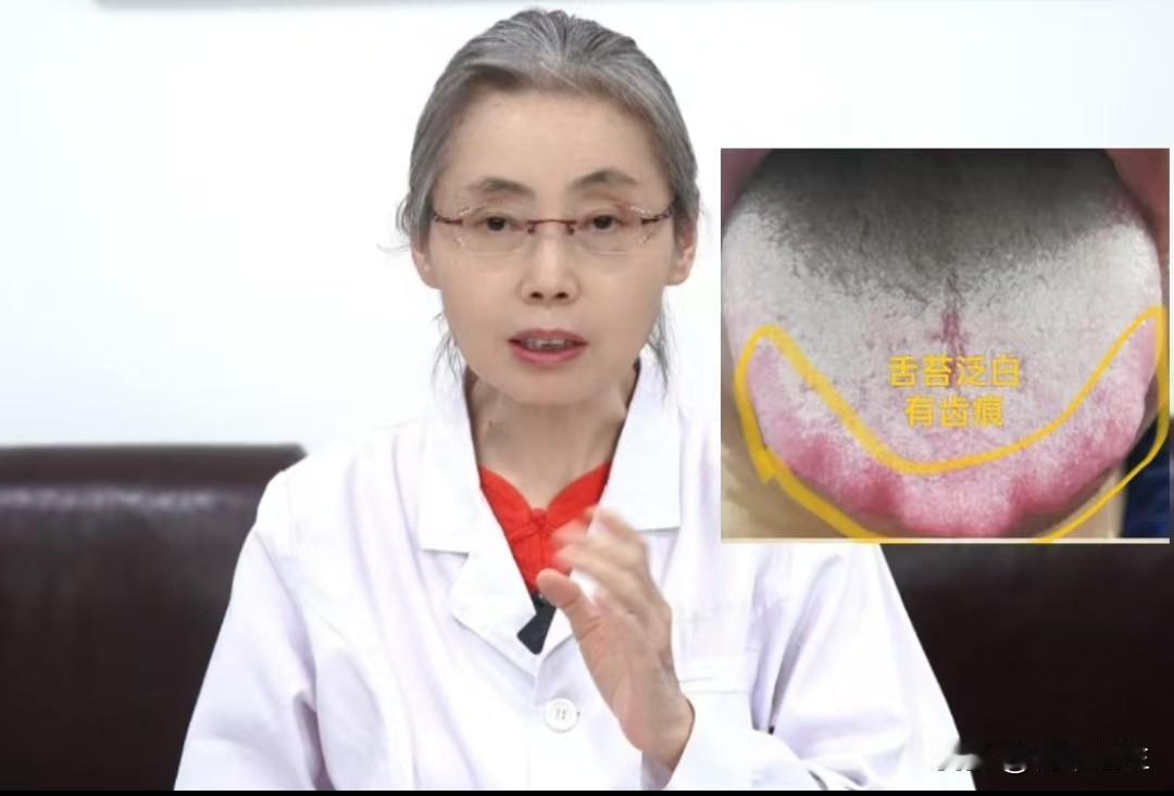 今天不是很忙，继续给大家看舌象，你发我看，挨个回复！

注意，拍的时候把舌头给拍