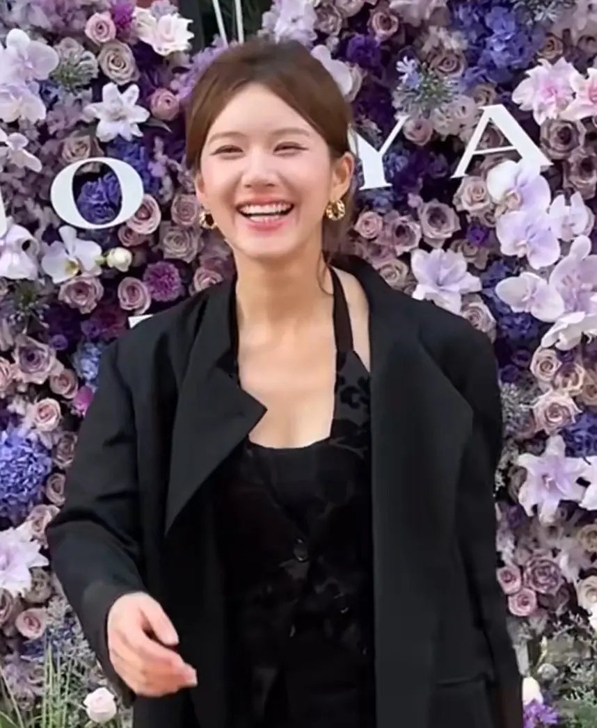 赵露思现在法令纹真的越来越严重了 ​​​