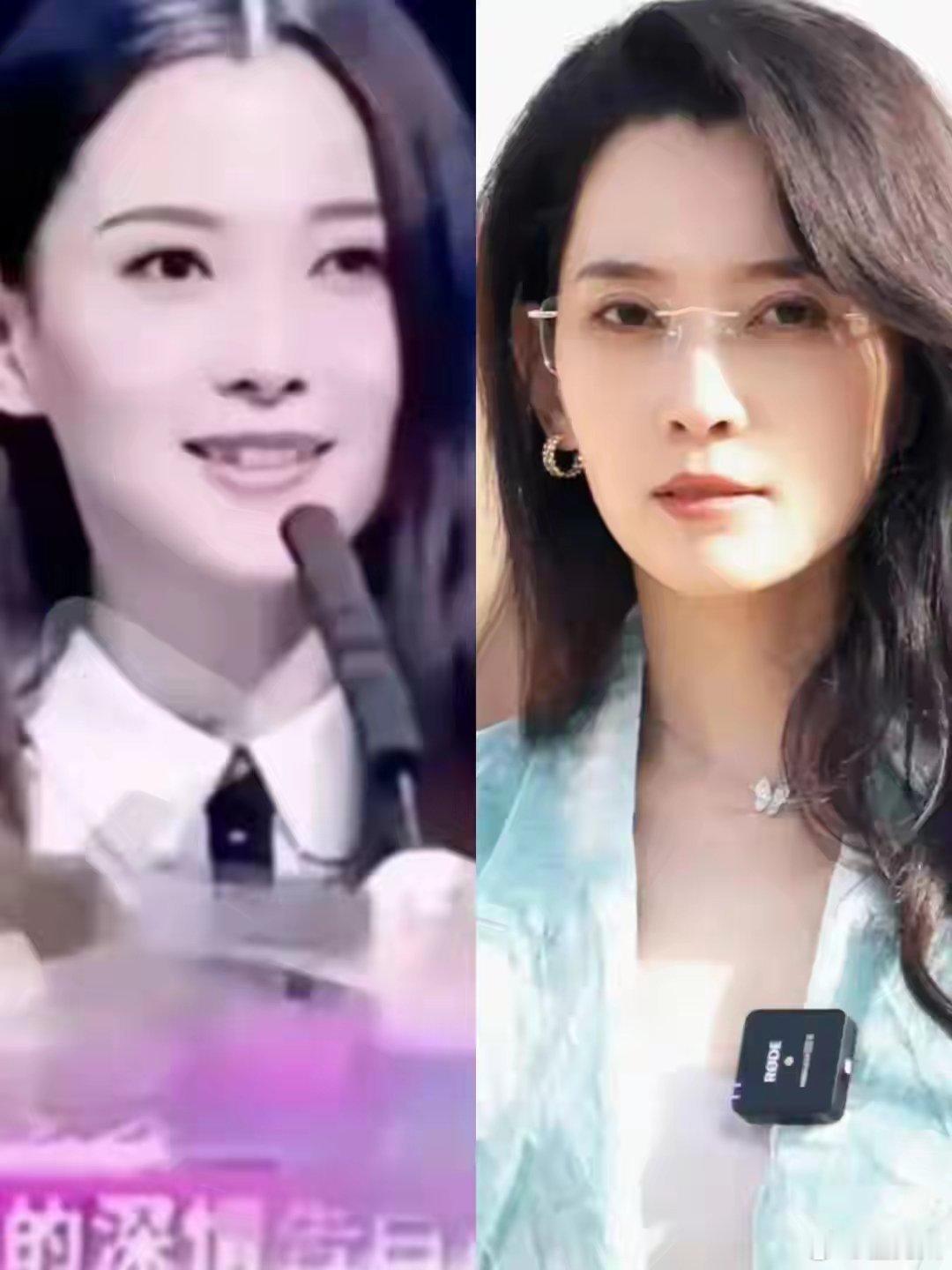 森林北回应整容传闻森林北（李巧）到底有没有整容？看她前后的照片对比就知道答案了。