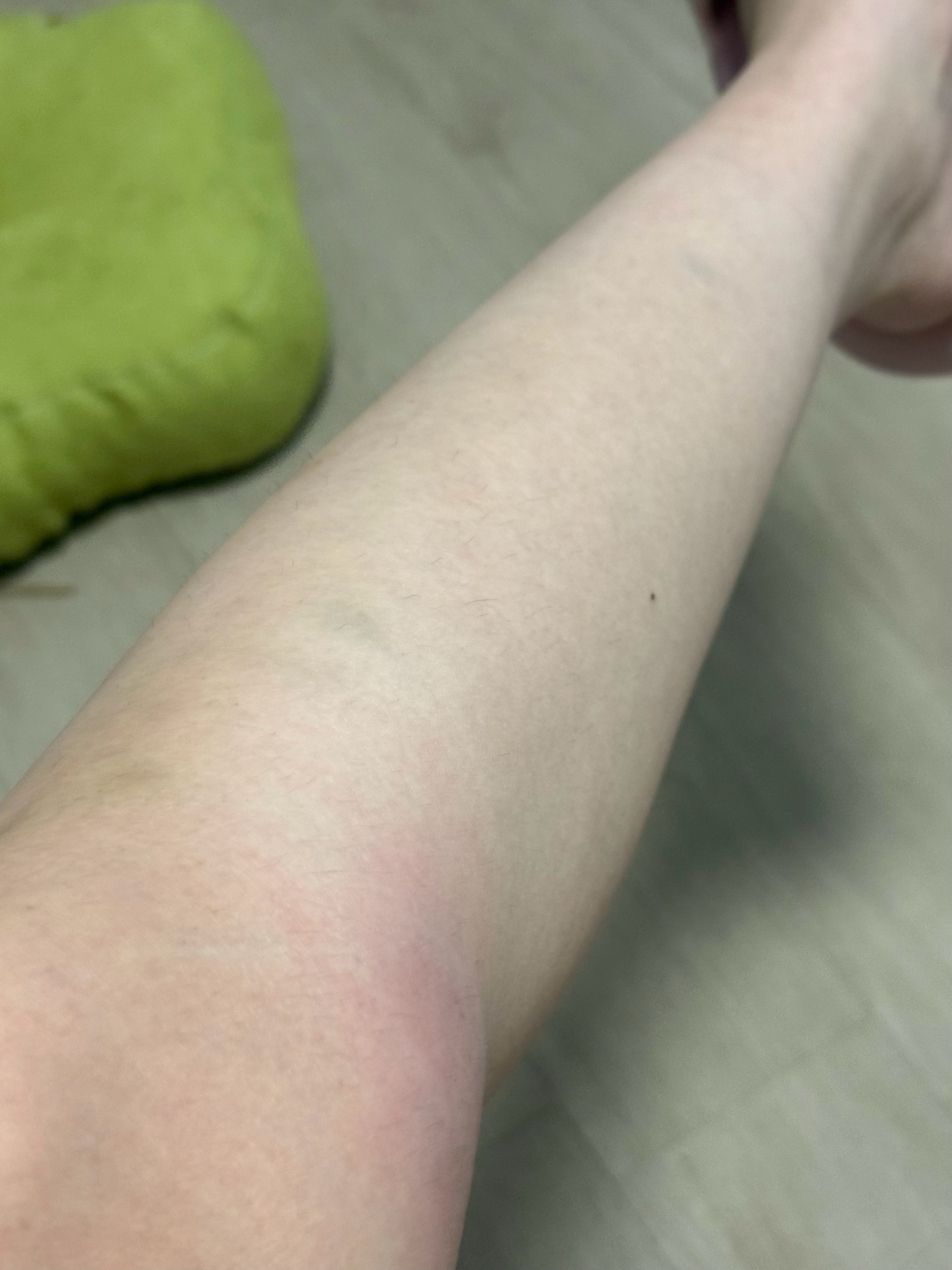 脆皮腿