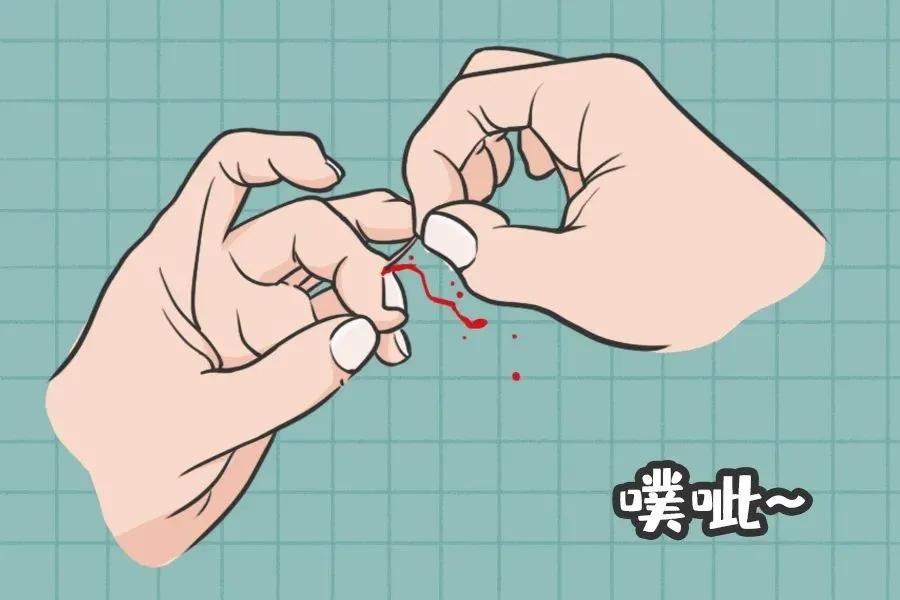 #健康真探社#【你还在拔倒刺吗？有人差点因它截断手指】有网友表示因为撕倒刺，骨髓