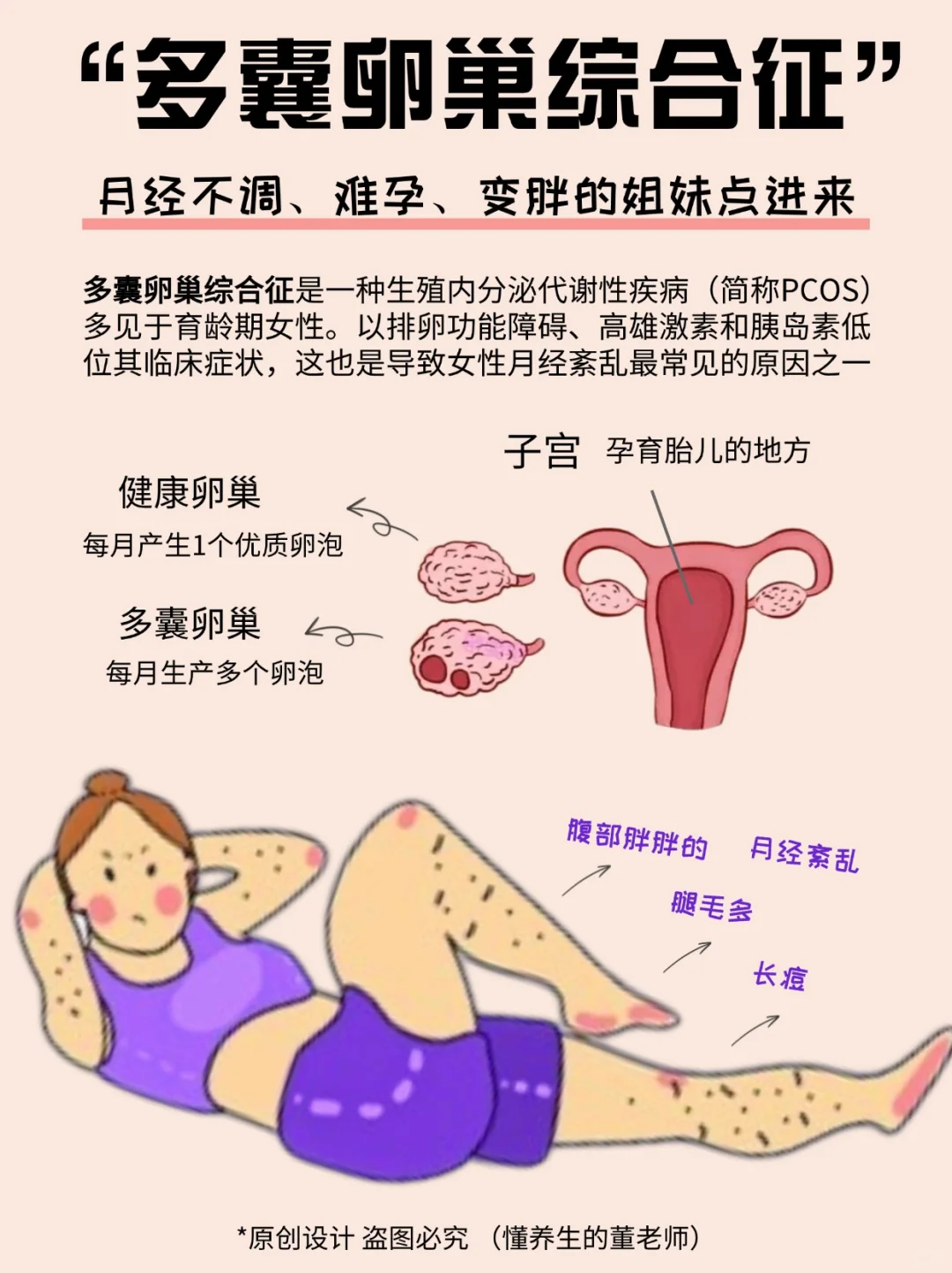 是谁在妖魔化多囊⁉️90%的多囊都能干预‼️