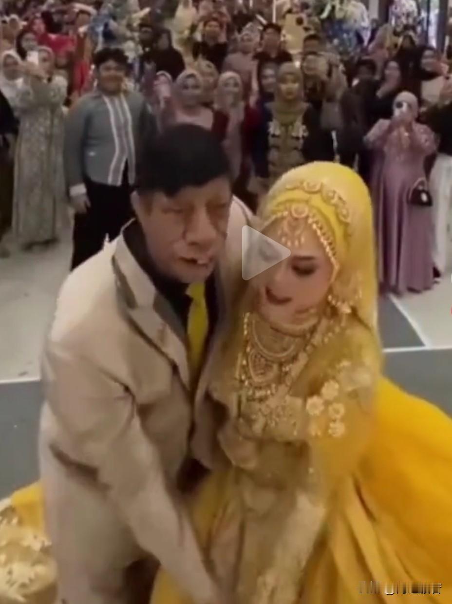 妥妥的青蛙王子！印尼这位新郎官的长相真够着急的。

姑娘貌美如花，佩服她的勇气，