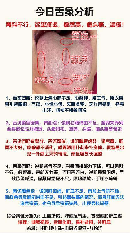 男人能力欠佳，还没几下就草草结束？中医教你这样调理