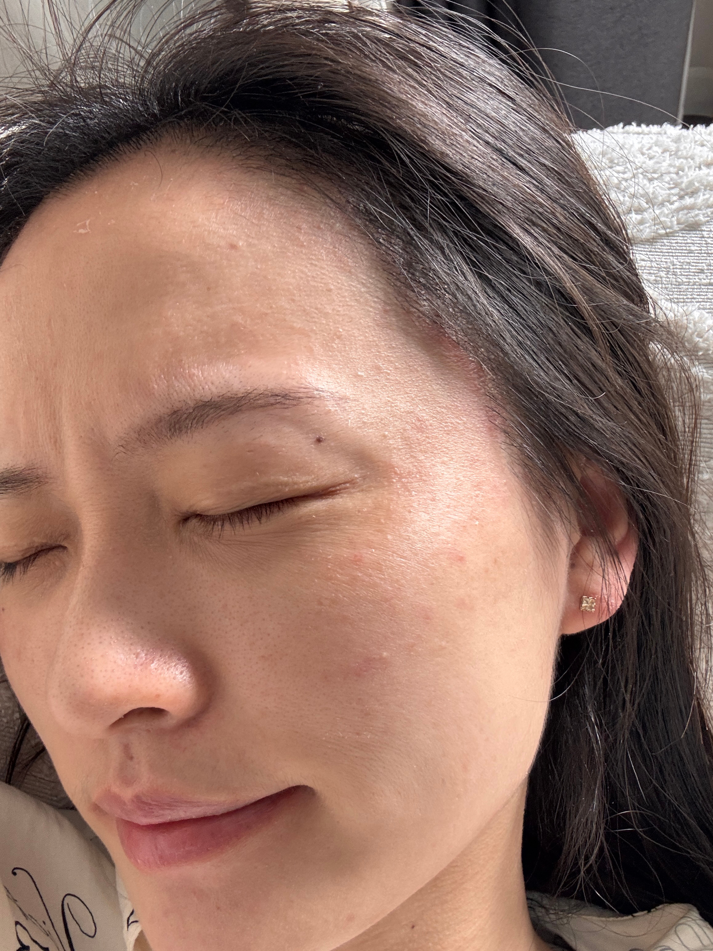 痒的我不想活了