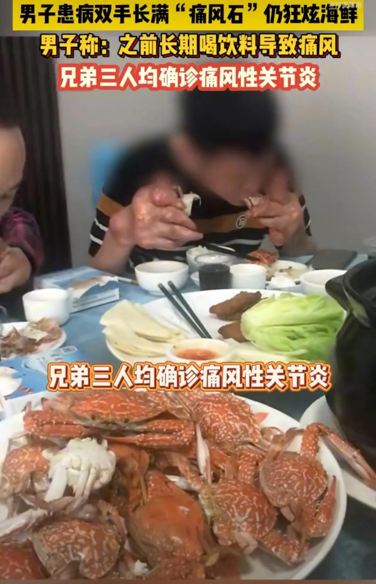 佩服得五体投地！
广西男子长双手布满“痛风石”已经变形严重，肿成“萝卜”却依然拿