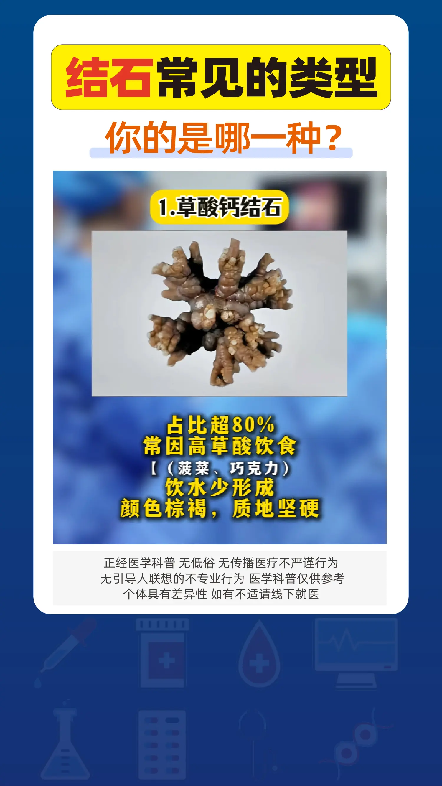 结石常见的类型，你的是哪一种？。