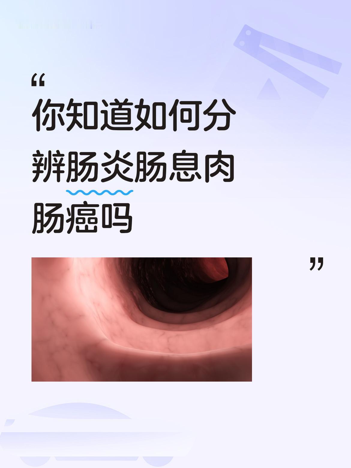 你知道如何分辨肠炎肠息肉肠癌吗