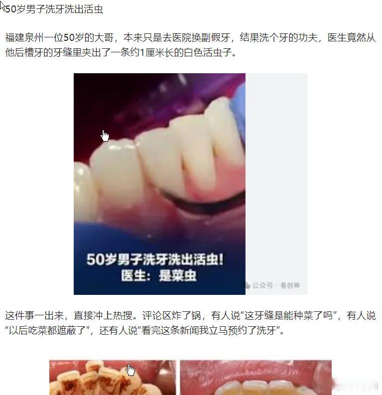 50岁男子洗牙洗出活虫还有人说“看完这条新闻我立马预约了洗牙”。网页链接