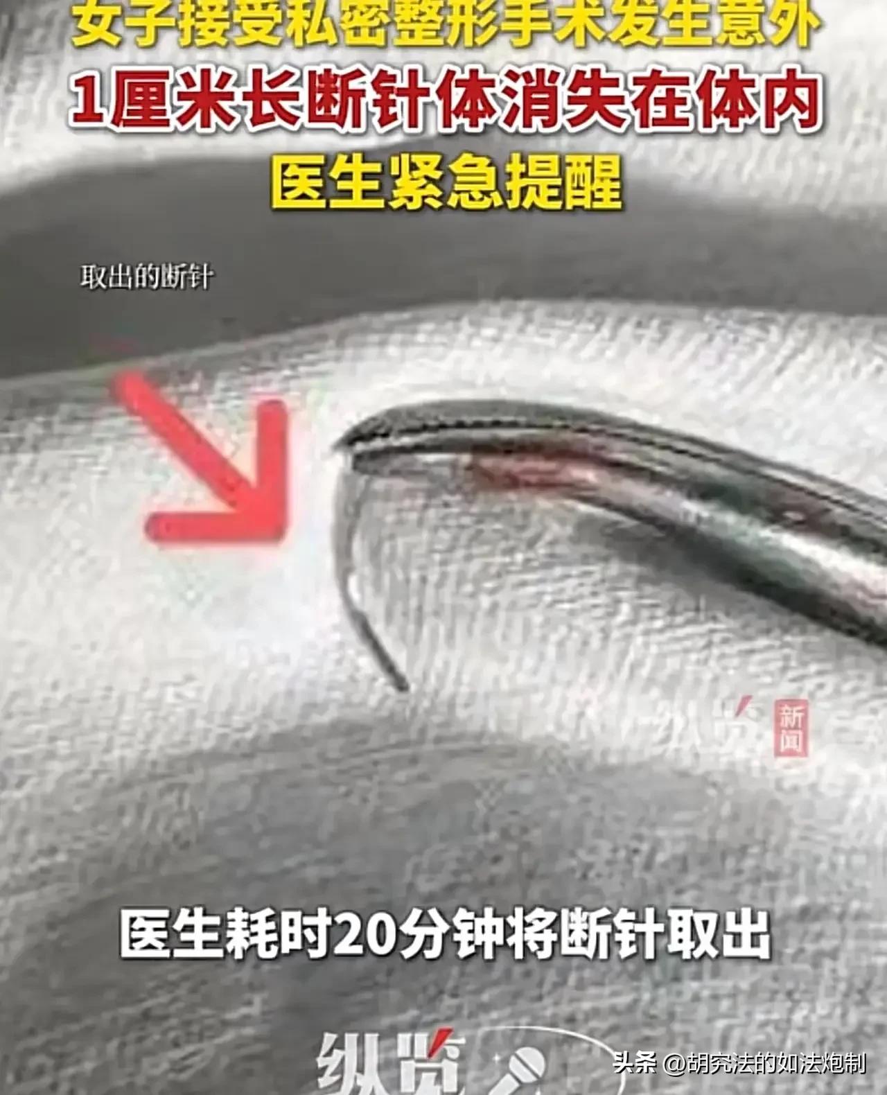 谁给的勇气？浙江，一女子生完孩子后，担心丈夫对她不满意，于是找了一家私立美容机构