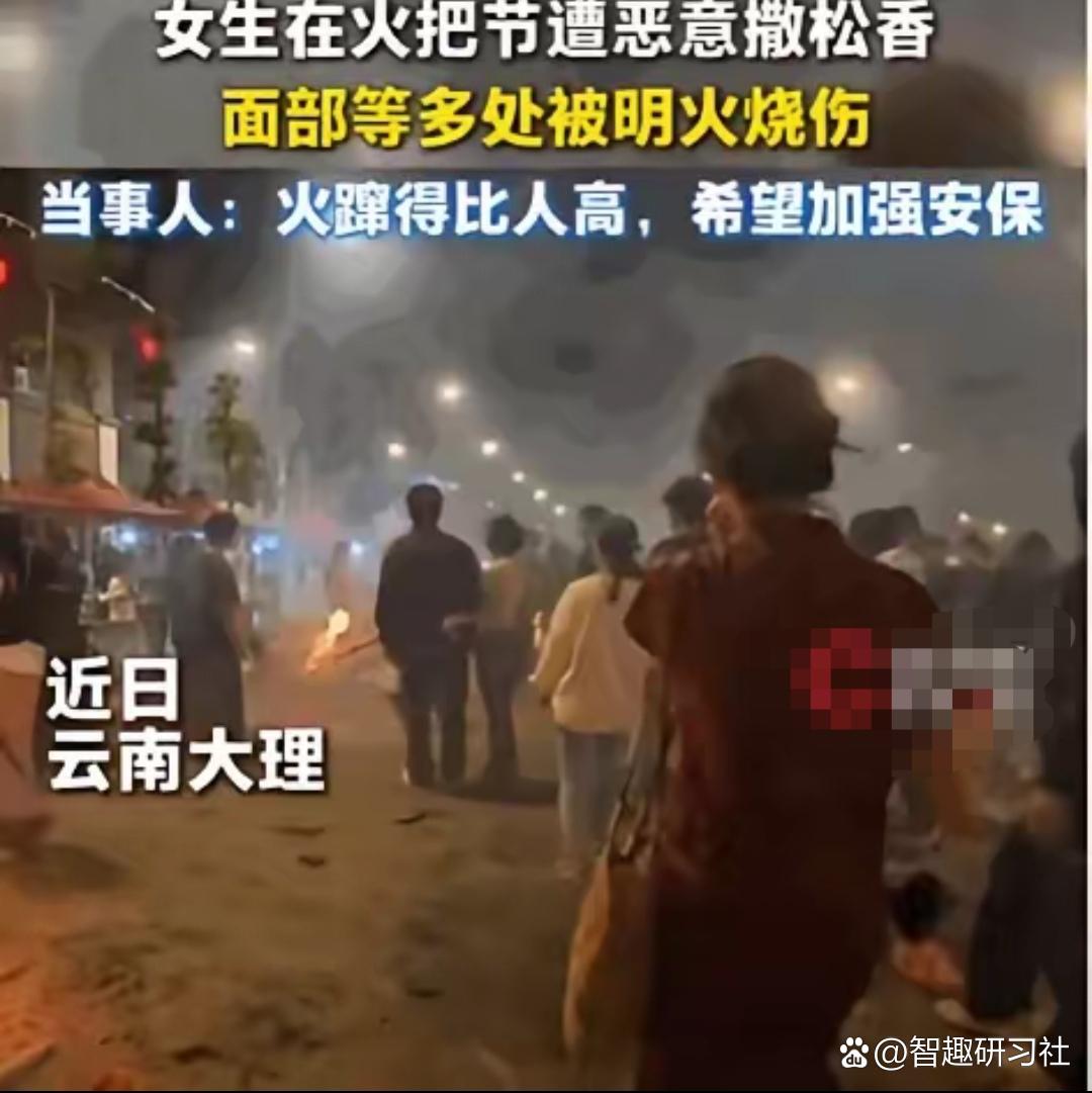 大理火把节女孩遭人群撒松香粉烧伤事件激起全网众怒，女孩身着旗袍参与节庆活动，被几