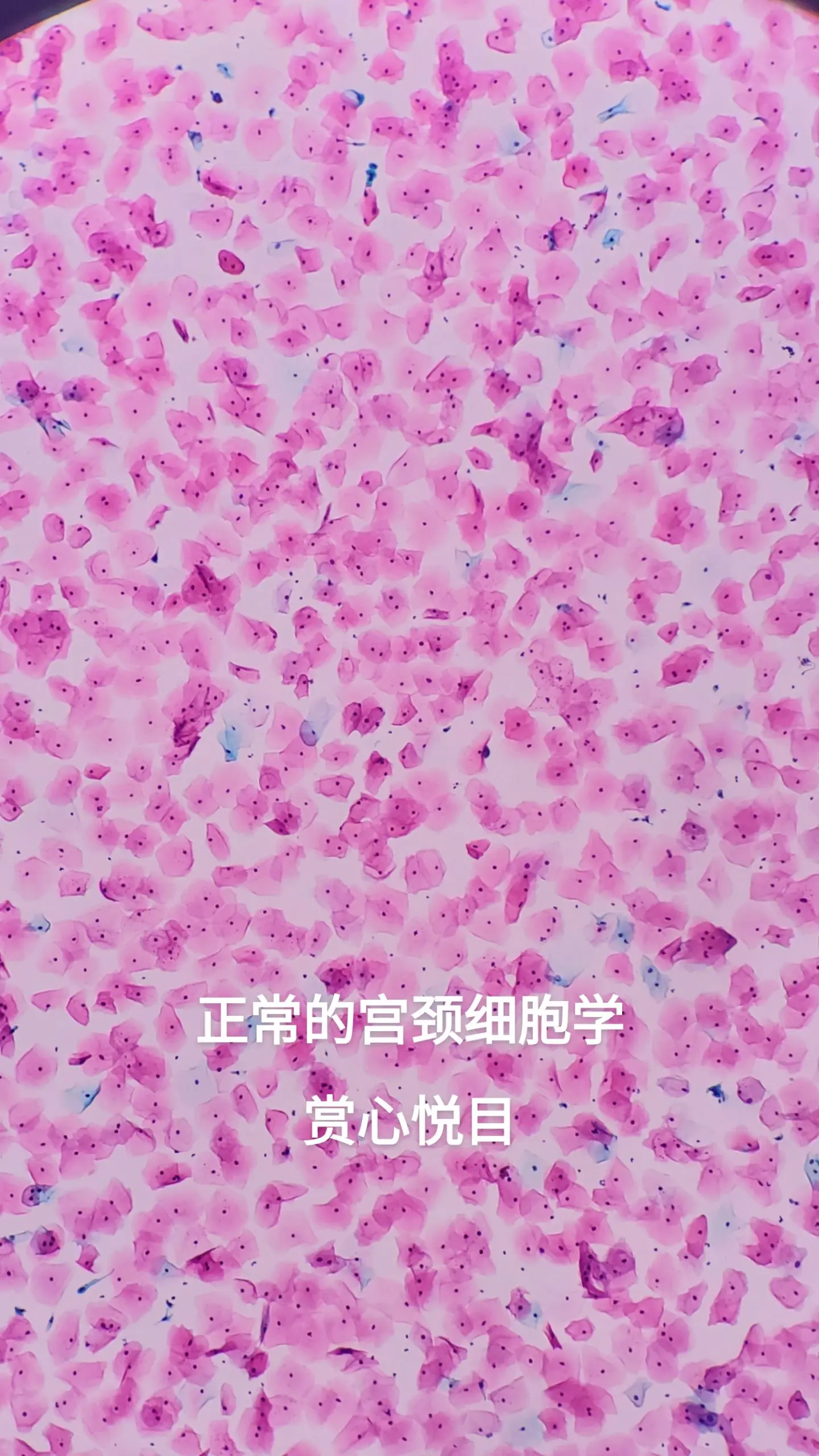 宫颈细胞学