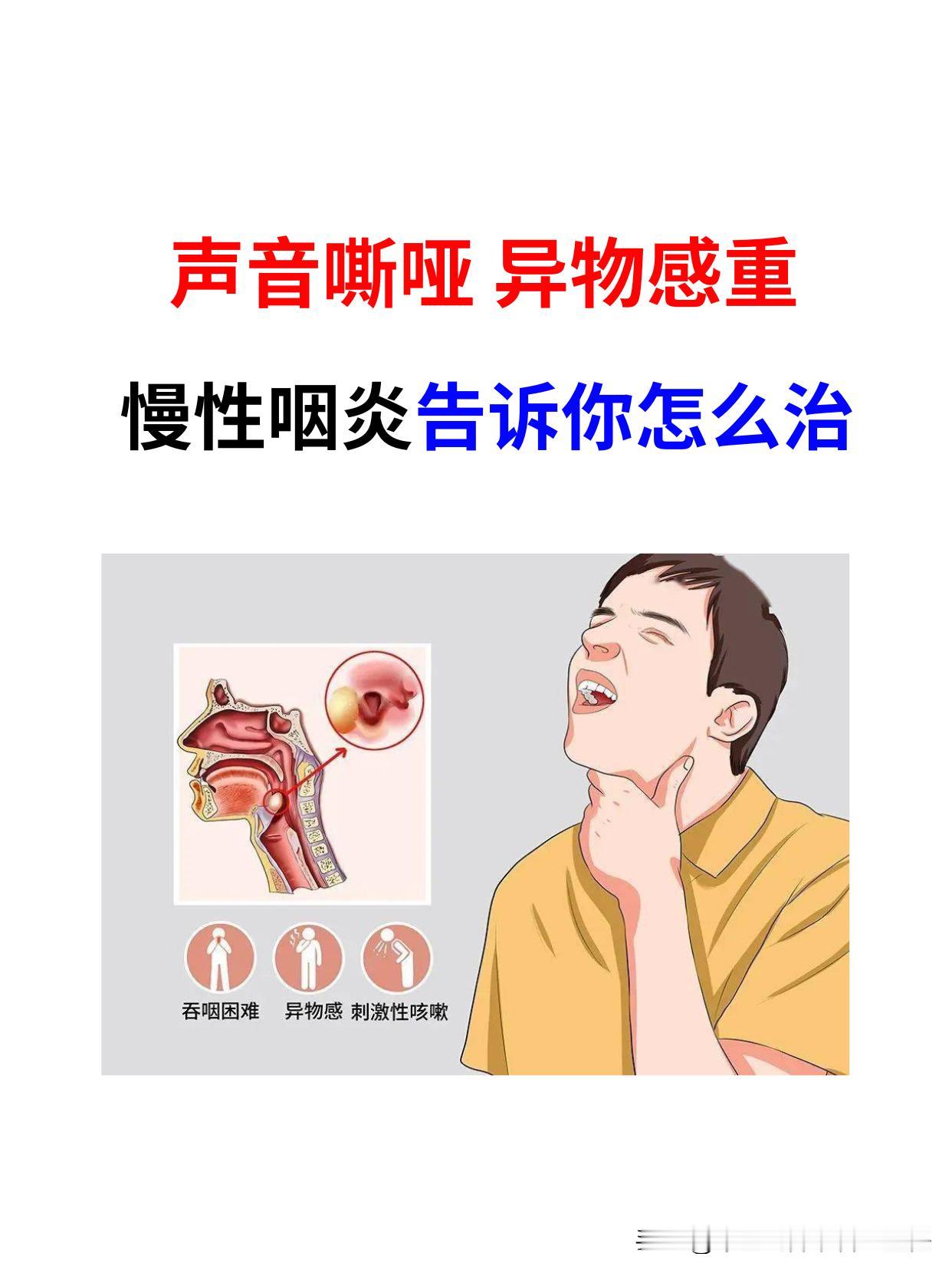 慢性咽炎，用一个词来形容：如鲠在喉。
 
这就是说我们能感觉到喉咙里是梗塞的，有