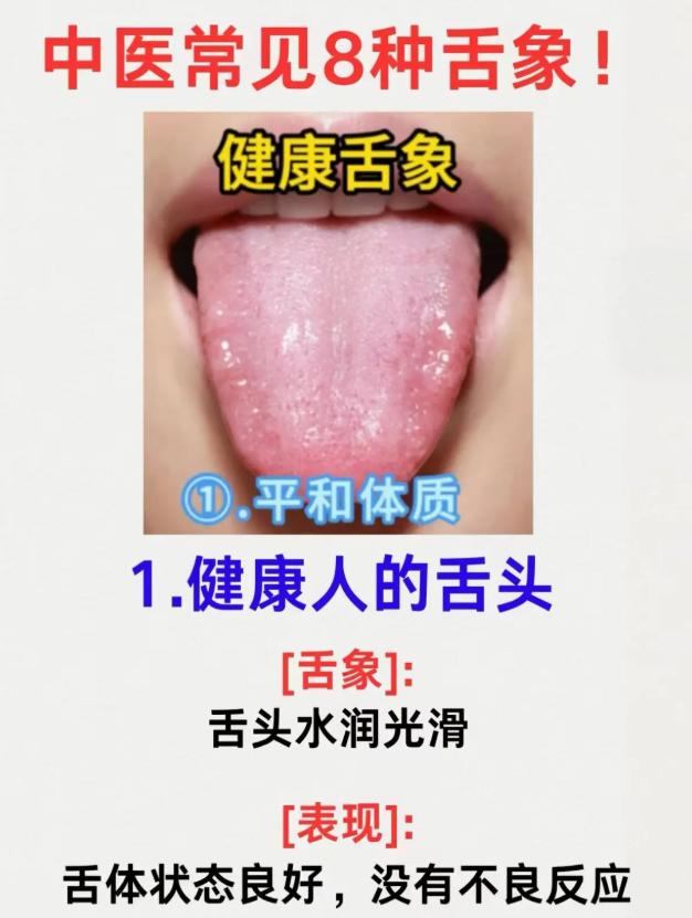 一文看懂：8 种常见舌象代表的体质