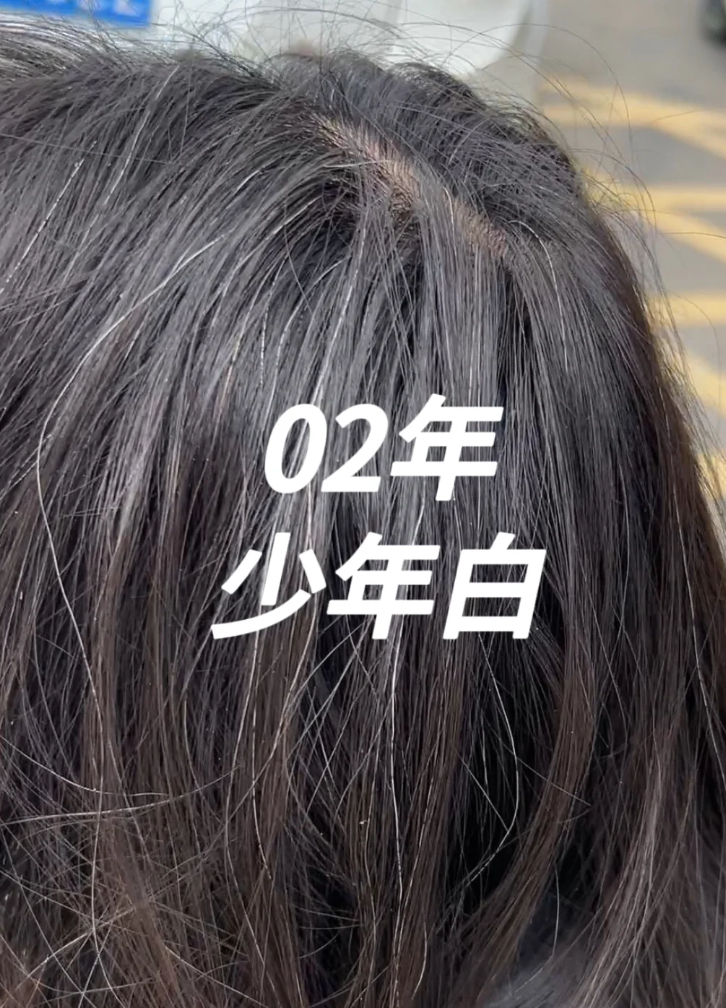 40岁女子不染发养了16个月的白发 少白头，身边很多人都有，我妈说是血热，可能跟