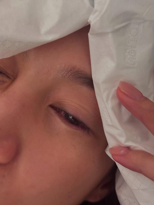 香港TVB女星傅嘉莉日前因换衣时被拉链割伤眼角膜，仅休息片刻便坚持返回剧组拍摄新