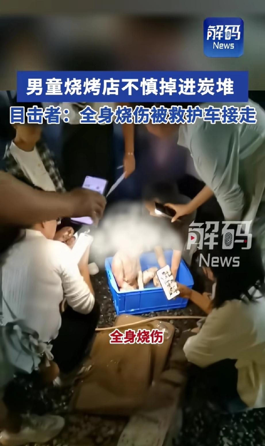 四川男孩跟父母到烧烤店用餐。男孩独自玩耍时，不慎掉进一米多高的碳烤炉，炉里还有烧