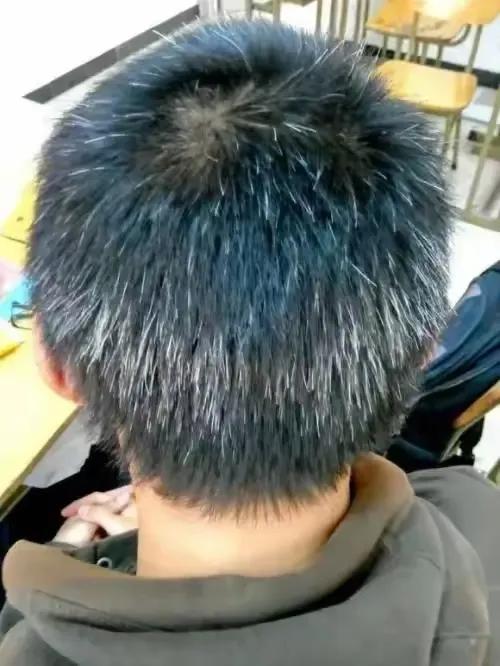 你是否为白发、脱发问题而烦恼？今天，我要为大家介绍一位老中医自创的通治白发、脱发