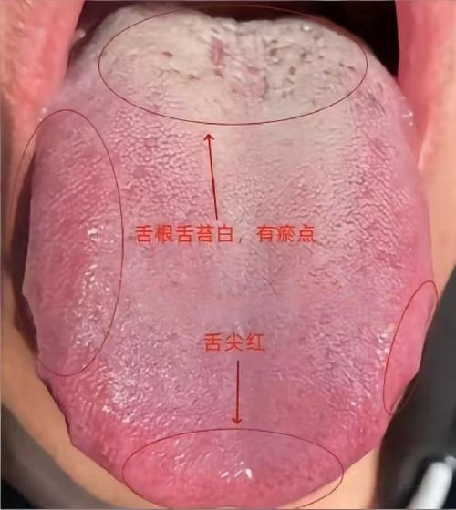 心肾不交别乱用药！从舌象看穿问题，这样调理才对
“都心肾不交了，用再多天王补心丹