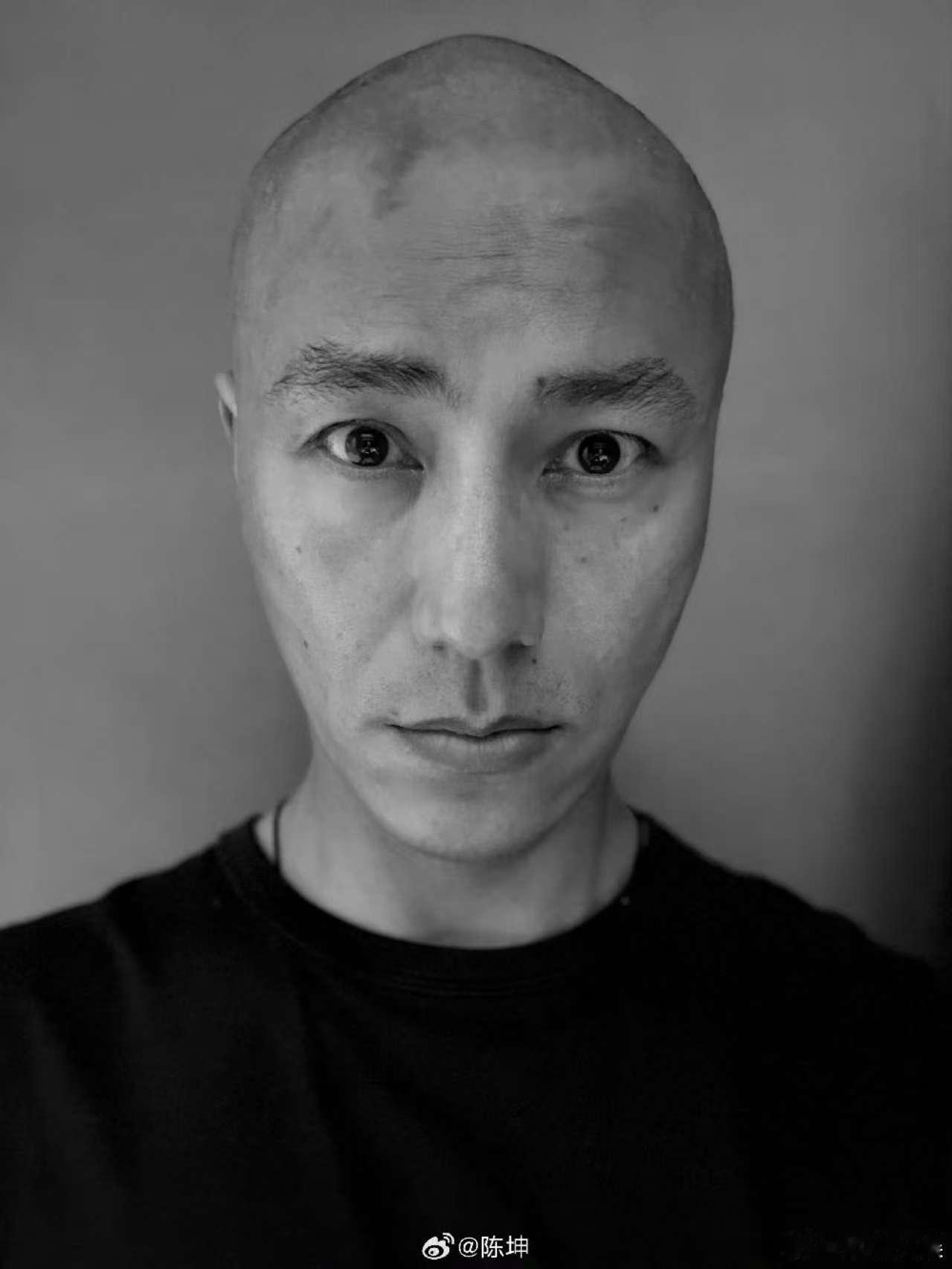 被陈坤吓到了陈坤剃光头陈坤剃光头，适合演反派，[鼓掌][鼓掌][鼓掌] ​​​