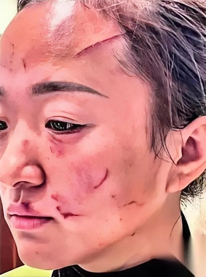 婆媳动手后续来了！

婆婆倒赔5万断关系？

看到这起婆媳互殴的结局，有人疑惑婆