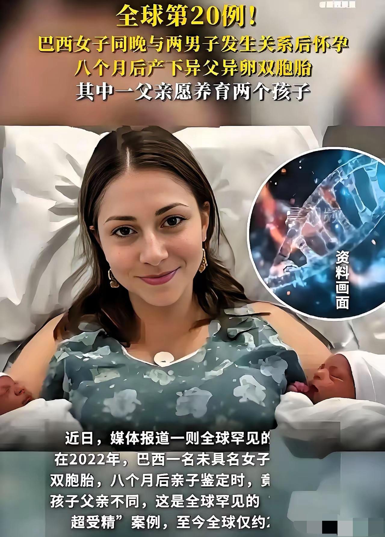 在巴西发生了一件匪夷所思的事情，一名女子同晚与两名男子发生了关系，这名女子后来怀