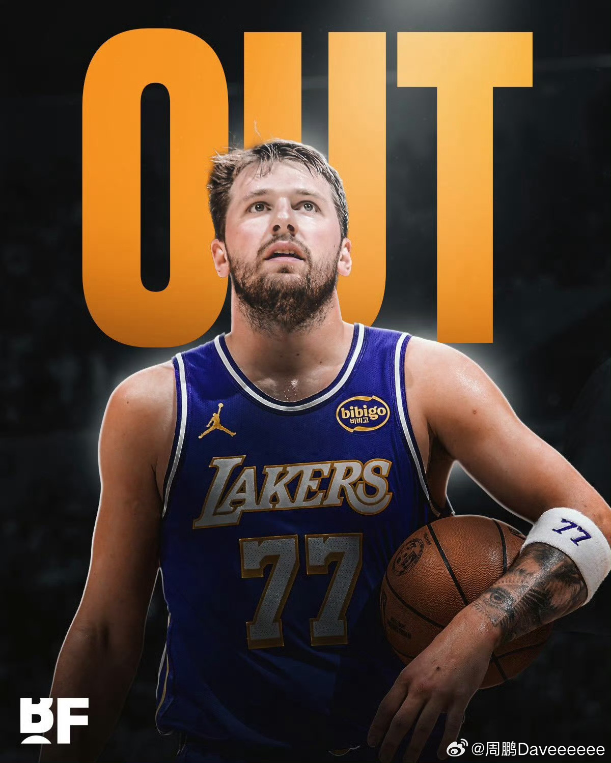 湖人官方：东契奇遭遇左腿筋二级拉伤，将缺席常规赛剩余比赛。 